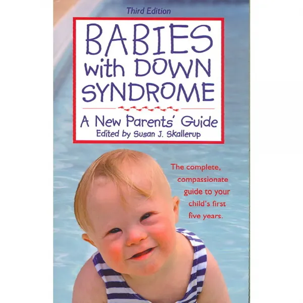Babies With Down Syndrome: A New Parents' Guide, Woodbine House