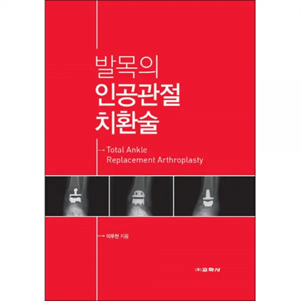 발목의 인공관절 치환술 양장본, 교학사