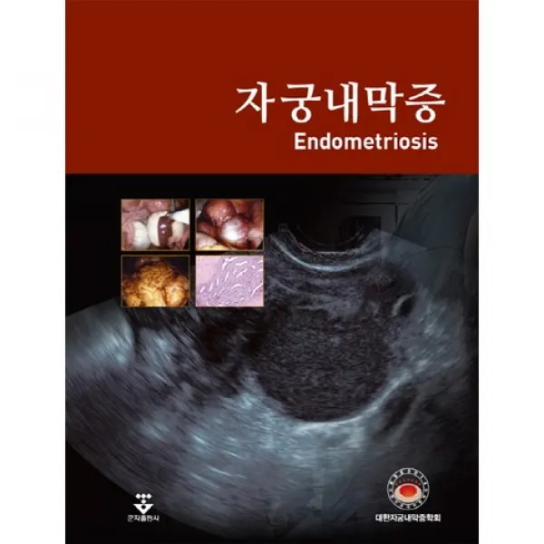 [군자출판사]자궁내막증(양장본 HardCover)_대한자궁내막증학회_2017, 군자출판사