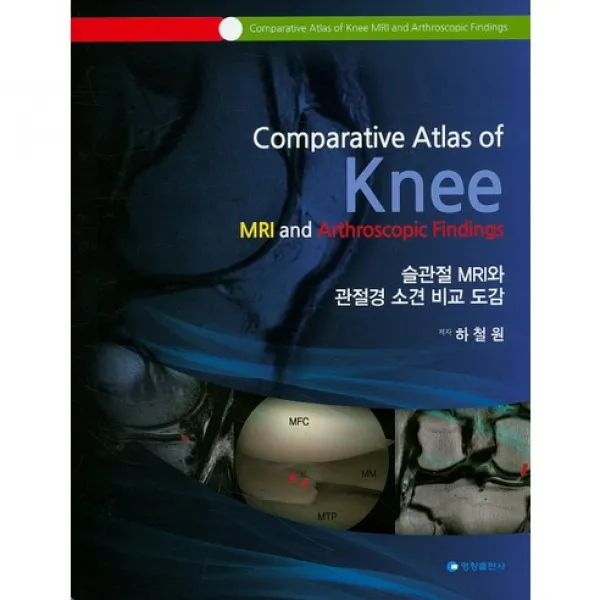 [영창출판사]슬관절 MRI와 관절경 소견 비교 도감_하철원_2016, 영창출판사