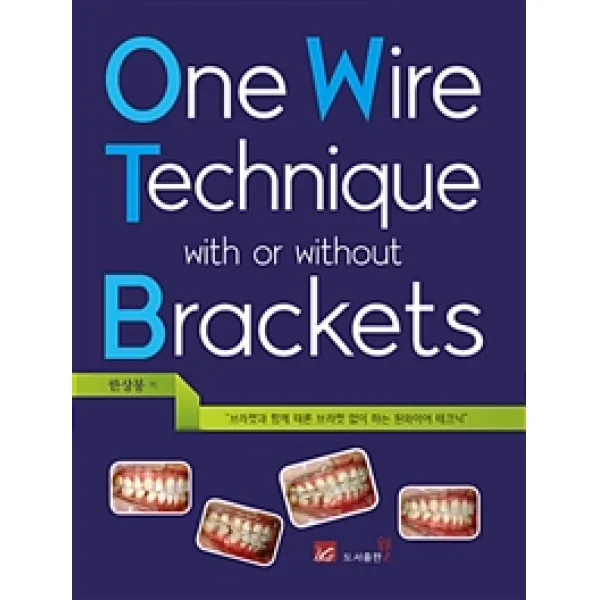 [웰]One Wire Technique with on without Brackets, 웰