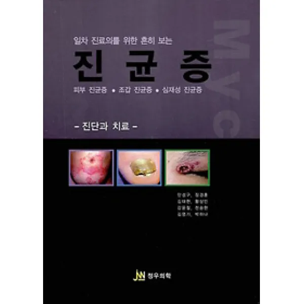 [정우의학]일차 진료의를 위한 흔히 보는 진균증, 정우의학