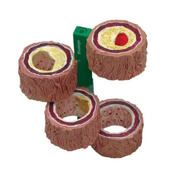 SHUNZAOR 동맥혈관 심혈관계 해부모형