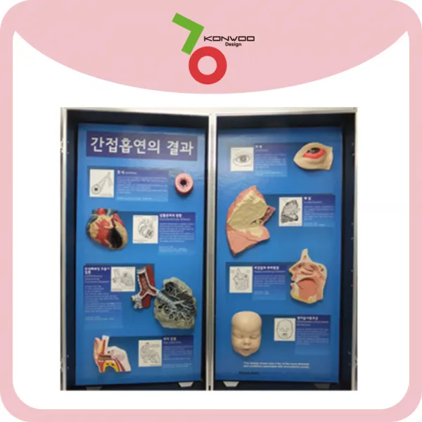 간접흡연의 결과 모형 79605 흡연 폐 금연교육, 1개