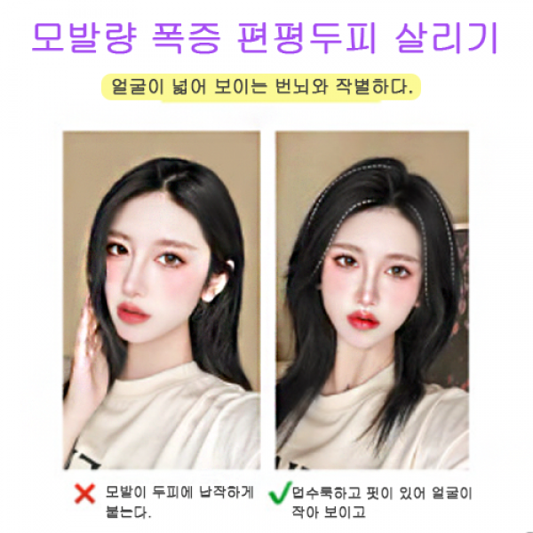가발패드 모근 리얼헤어 패치 볼륨업 히든노치 원터치 양옆머리 보발녀, 12 전진발-듀얼10cm[자연흑]