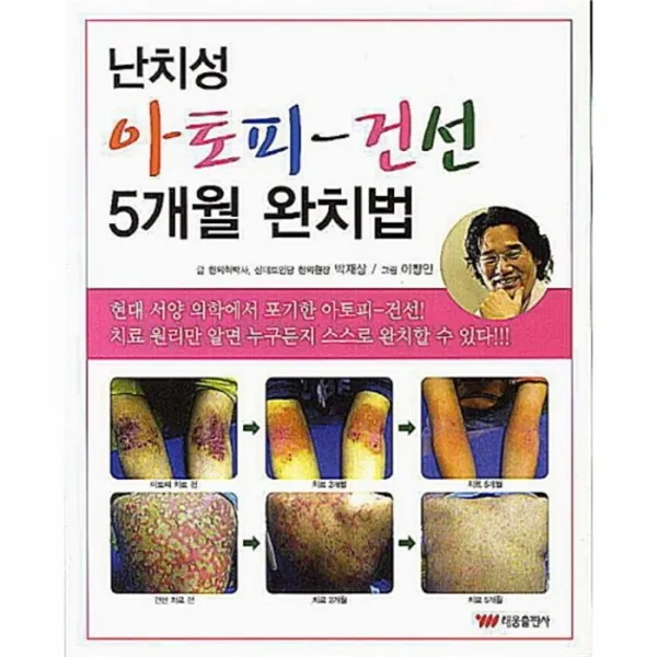 웅진북센 난치성 아토피 건선 5개월 완치법, One color | One Size@1