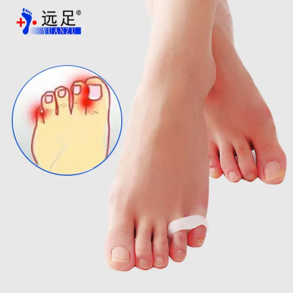발가락교정기 엄지손가락 외반증 교정기 발가락 발가락기기 중첩 분리기 테이퍼드 정기, T01-프리사이즈