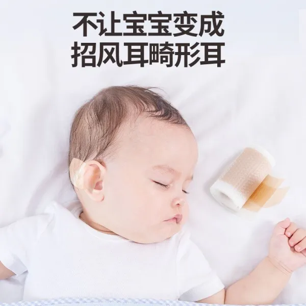 아기집게핀 세우다 머리집게 스티커 귀밑귀 변한다고 풍이 신기 교정기 기형 드리우다 체형관리, 프리 귀 보정 스티커 *1롤 길이 1메터