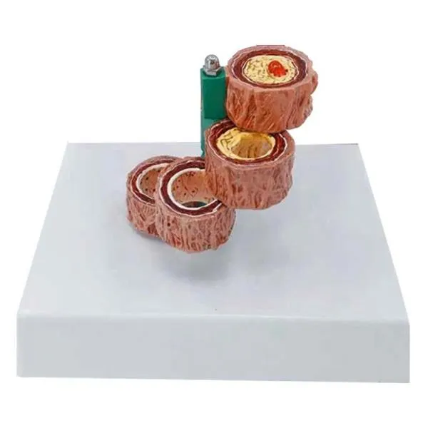 혈관 동맥의 인간 경화 동맥 경화증 모델, 한개옵션0
