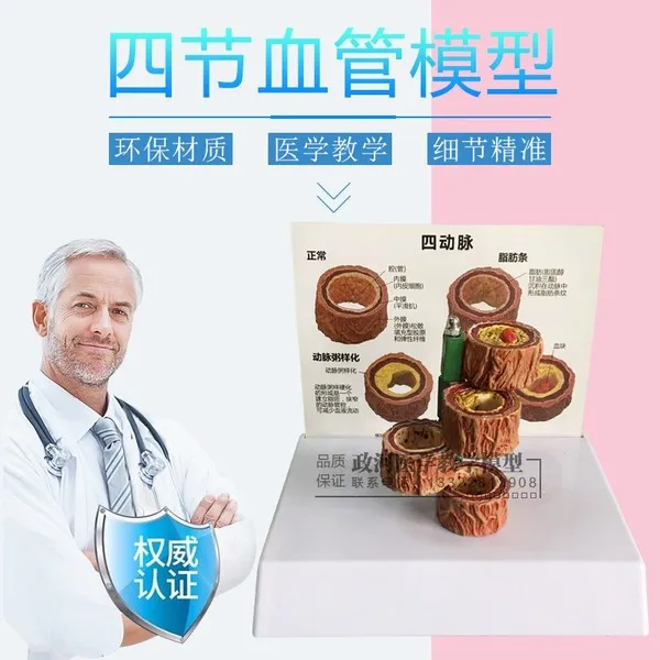 심혈관 질환 동맥 경화 혈관 해부학 모형 모델 데모 교구 인간 4 섹션 혈관 모델