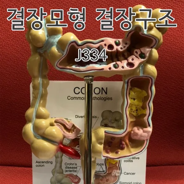 J334 결장구조 결장모형 대장 직장 십이지장 항문 인체모형, 1개