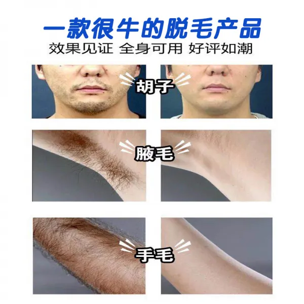 수염 탈모 엑스트라 수염 탈모 엑스트라 남성 얼굴부위의 털구레나룻 발끝선 다리와 겨드랑이 털전신 제거 털신기 조립 업그레이드 탈모 억모, 단일상품