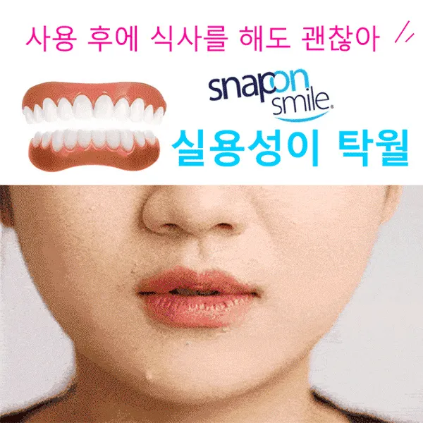 실리콘 임시틀니 4세대 미백틀니 윗니+아랫니, 미백 틀니 (4세대 미백 틀니)*2