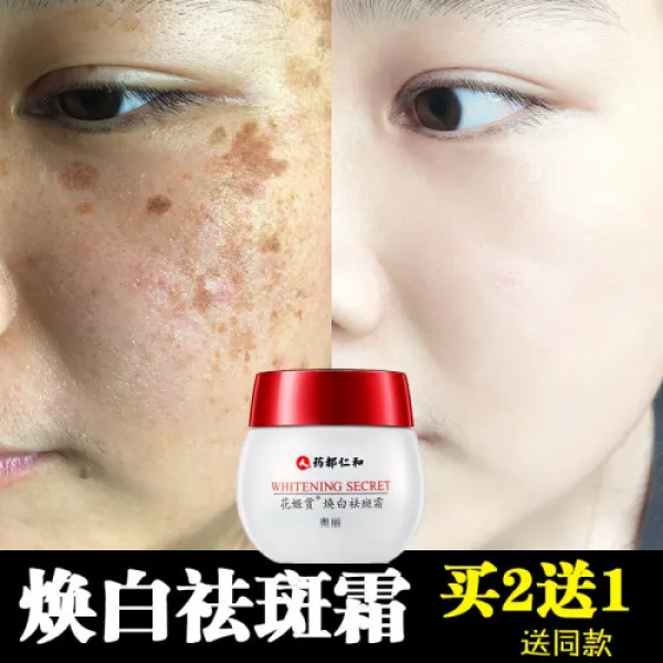 약도인과 미백반점크림남여사 희석반점한약반점제거검은주근깨 각종반점 환백반점크림30g, 1개, 0ml