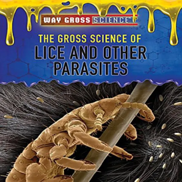 The Gross Science Of Lice And Other Parasites Way Gross Science 이 및 기타 기생충에 대한 총체적인 과학 웨이 총 과학 1