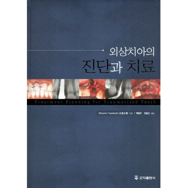 외상치아의 진단과 치료, 군자출판사