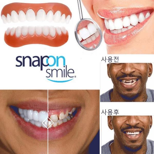 Snapon Smile 구강 전용 실리콘 임시틀니 4세대 미백틀니 윗니+아랫니 인공치아틀니, 윗니용