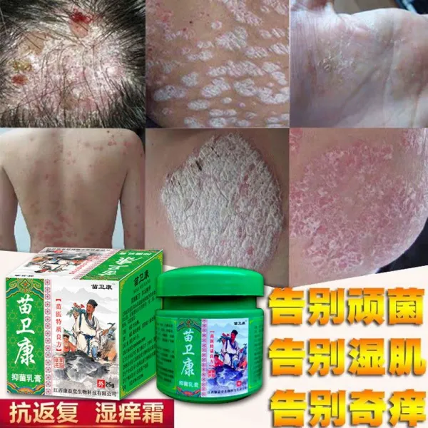 새싹 강 위다 피부 외용으로 나타났다 유약 모기 해충 물다 가려움 방지 크림 간지럽다 소가죽 김빠지다 흐물흐르다 발가락, 1