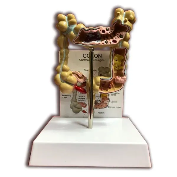 결장구조모형 J334 대장 십이지장 직장 항문구조 사이즈 18x15x9cm 제품 무게 0.6kg 인체모형