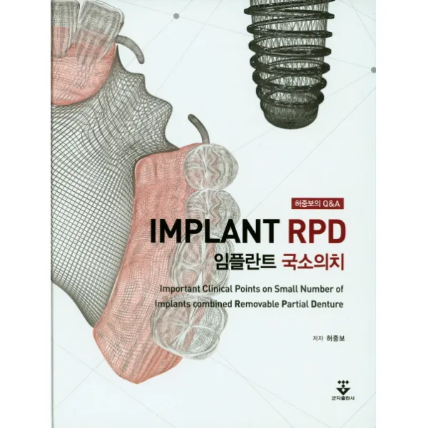 임플란트 국소의치:허중보의 Q&A, 군자출판사