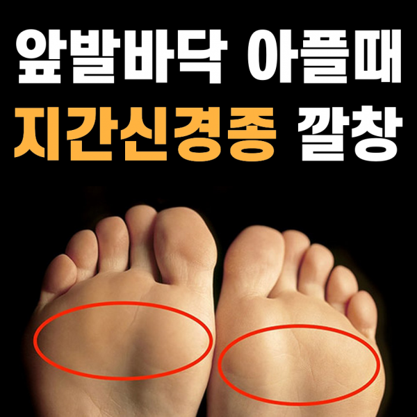 이룸건강 지간신경종깔창