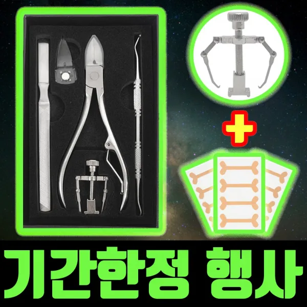 고요잠 내성발톱 교정기 Dk 77 1세트