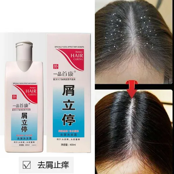 일품강왕샴푸항균비듬제거지근지근성기름심층클렌징제로 비듬이 400ML 한병 없어진다, 단일상품