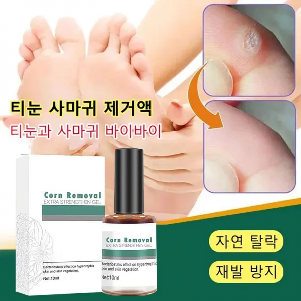 티눈 제거 액 초본 에센스 손가락 발바닥 티눈 제거 액 10ml, 무통증 티눈 사마귀 제거액(10ml)*2