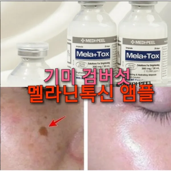 글루타치온 검버섯제거 앰플/굵은주름 모공 늘어진피부 리프팅/멜라논크림/얼굴 검버섯/검버섯제거/기미에좋은팩/기미치료/검버섯제거비용, 백옥앰플톡신+아이보톡크림 (1+1)