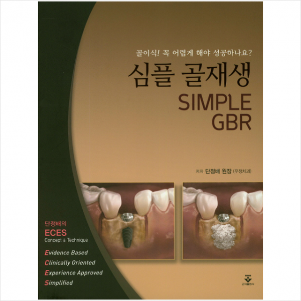 심플 골재생