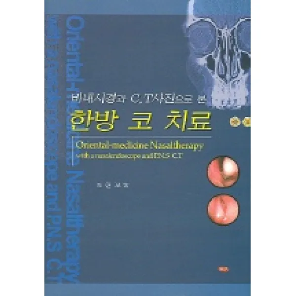 한방 코 치료 (비내시경과 C.T사진으로 본), 주민출판사