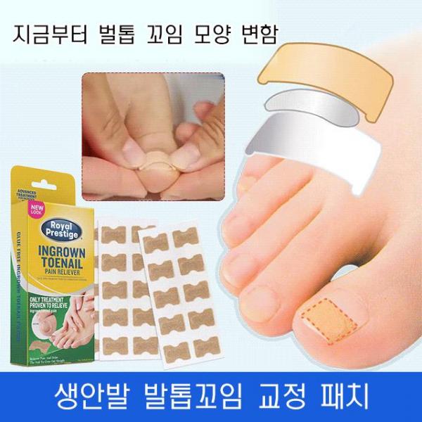 발톱꼬임 교정 패치 100장 가법고 간단함 다듬하지 않고 발톱손상 없음 최저 6475원 1박스, (발톱꼬임 교정 패치 1박스 50장)x2