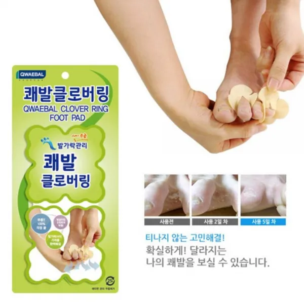 찐노마진몰 쾌발 발냄새 발가락 무좀 제거 클로버링 120매