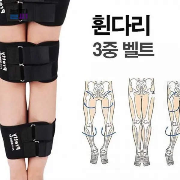 허리고정기 오다리 휜다리 안짱다리 보정 3단 벨트 밴드 발목보조기 오다리고정 발가락패드, 1개