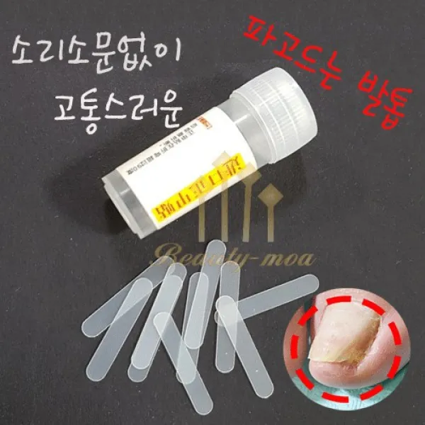 [안산뷰티모아] [내성발톱교정]리필팁 통당10pcs 파고드는 발톱교정 브레이스 내향성 발톱 정리기(큐렛) 보조기 크랄레글루2g 접착제 문제성발톱 엑티베이터 50ml 캐시아 핸드스킨 100ml 크랄레 교정팁 선택 (안산뷰티모아), 1통, [교정팁/소형]3*23mm(10pcs)