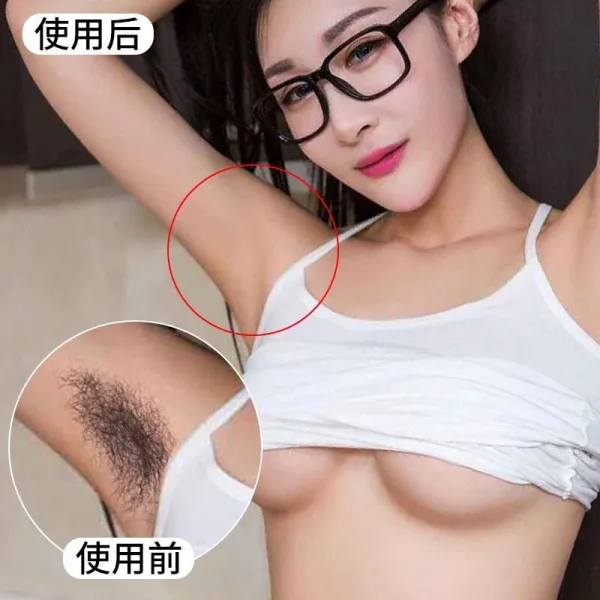 전음 떨이~털빼는 고약 겨드랑이 남자애들 알레르기 방지 전신에 다리의 털이 있는 학생 개인용 수염, 단일상품