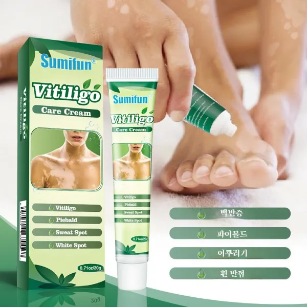 Sumifun 1+1 백반증 피부 백반증 어루러기 치료 연고, 20g