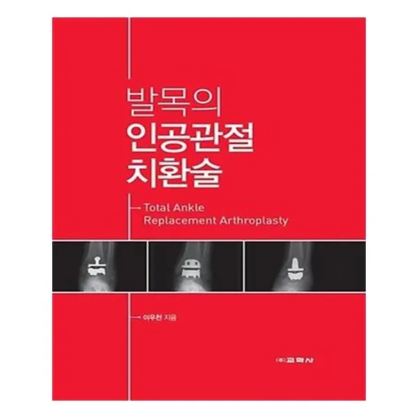 발목의 인공관절치환술