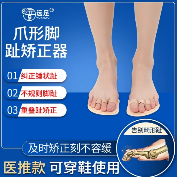 프레쉬영 원족 마쓰다 포스트 보정 겹침 분지 다듬이질 가식 꼬불꼬불 교정, 균일 고정 한 개 발가락 구분하지 않고 좌