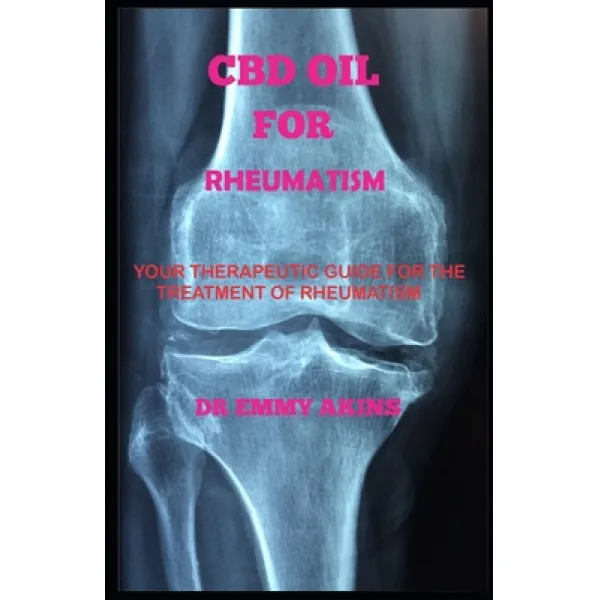 CBD Oil for Rheumatism: Your Therapeutic Guide for the Treatment of Rheumatism Paperback, Independently Published