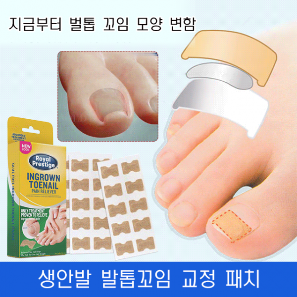 발톱꼬임 교정 패치 염증통증완화 테이프 발톱테이프 내성발톱교정 테이프 100장/1박스, 발톱꼬임 교정 패치(1박스 100장)*1