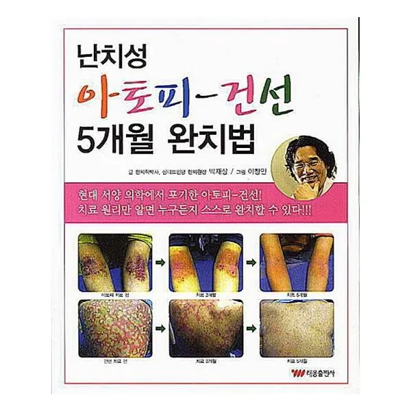 난치성 아토피 건선 5개월 완치법