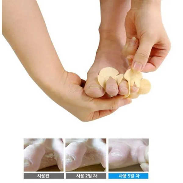 발습기제거밴드 땀 억제 발가락링 스타킹발냄새제거제 발다한증 습진 발바닥패치, 120매