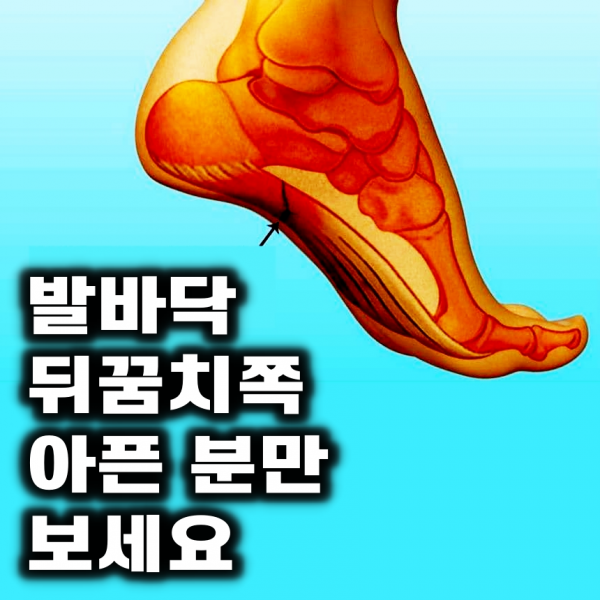 이룸건강 발편한깔창 푹신한깔창 쿠션좋은깔창