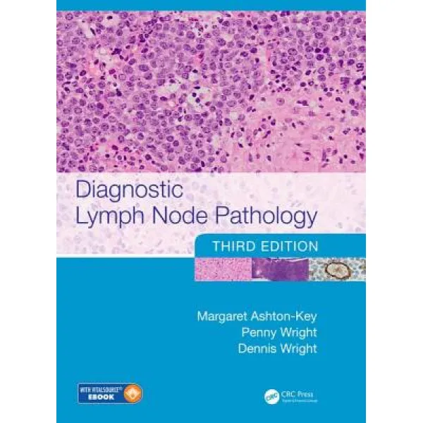 Diagnostic Lymph Node Pathology Hardcover, CRC Press