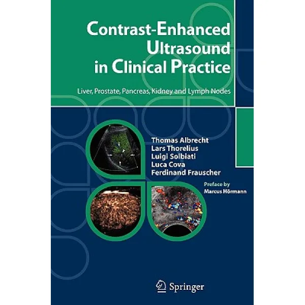 Contrast-Enhanced Ultrasound in Clinical Practice: Liver Prostate Pancreas Kidney and Lymph Nodes Paperback, Springer