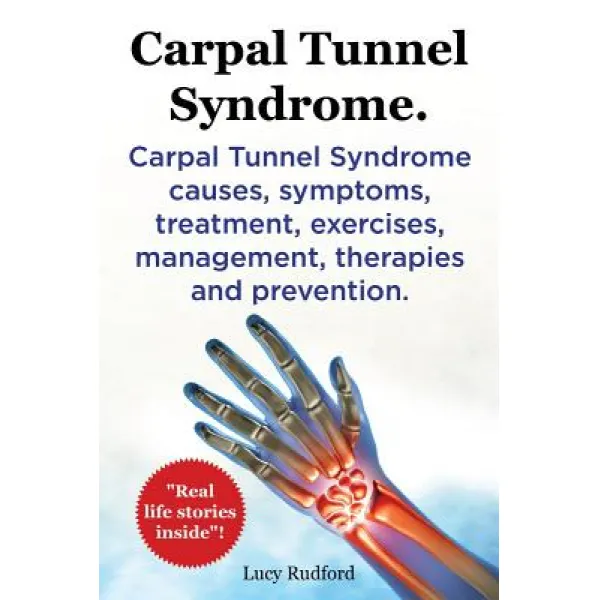Carpal Tunnel Syndrome. Carpal Tunnel Syndrome Causes Symptoms Treatment Exercises Management The..., Imb Publishing Carpal Tunnel Syndrome Cts