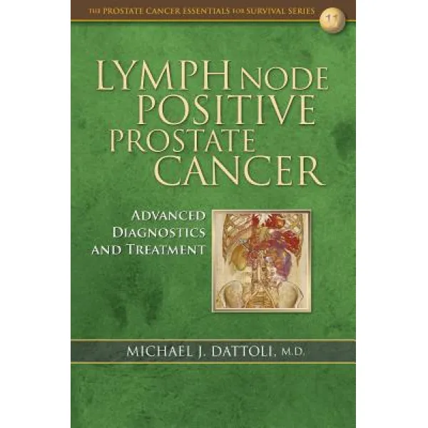 Lymph Node Positive Prostate Cancer: Advanced Diagnostics and Treatment Paperback, Createspace Independent Publishing Platform
