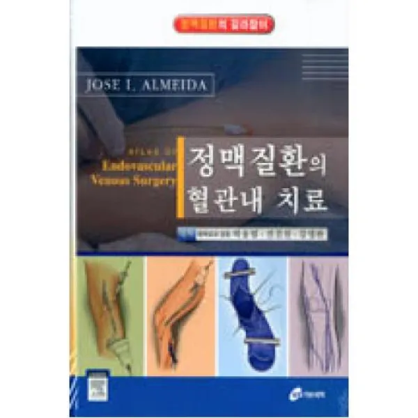 정맥질환의 혈관내 치료(정맥질환의 길라잡이), 가본의학서적 (구)가본의학(주)